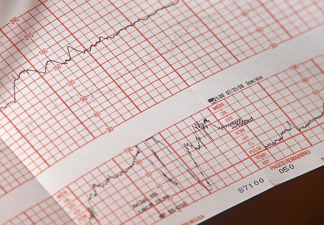 Přenosné EKG usnadní a urychlí vyšetření